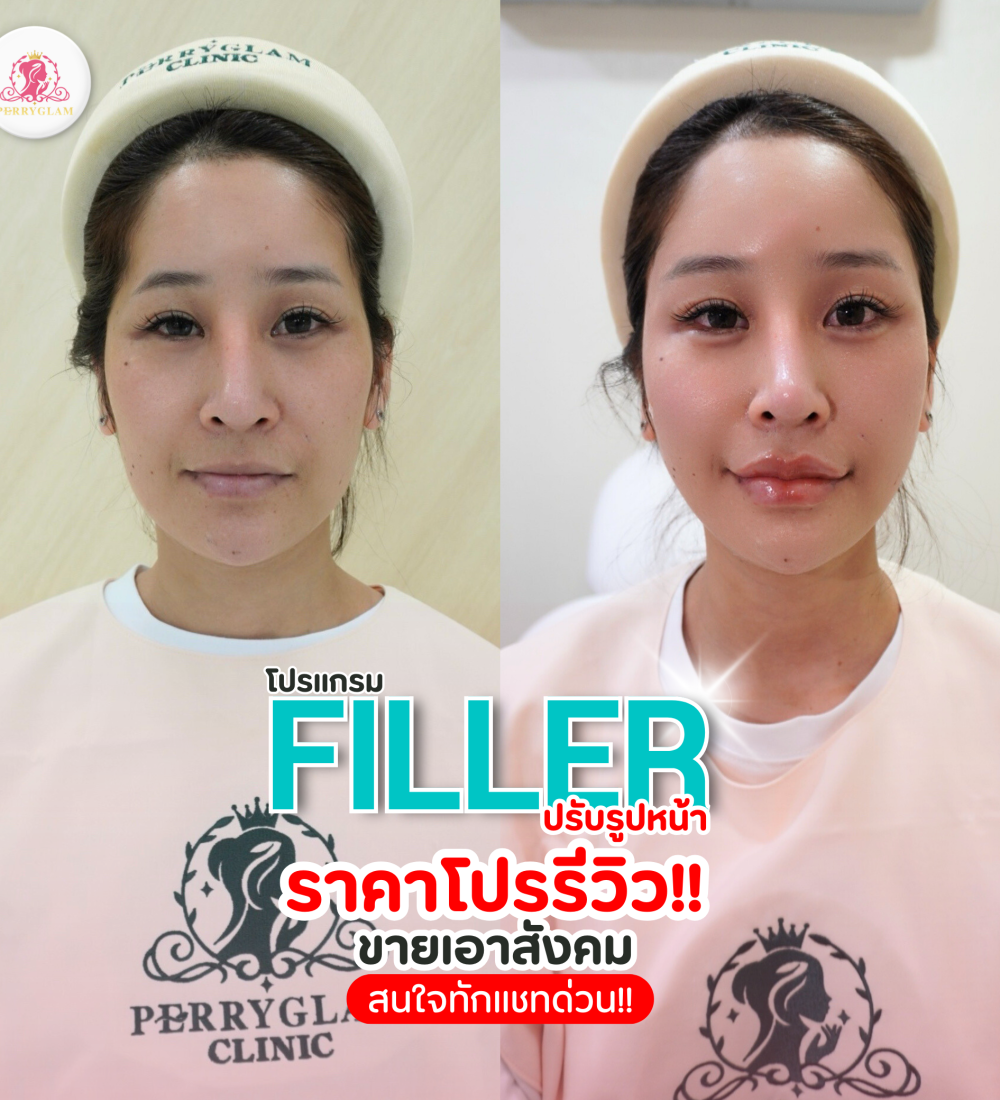 โปรแกรม FILLER ปรับรูปหน้า แก้รูปหน้าให้สมส่วน โปรแกรม FILLER ปรับรูปหน้า แก้รูปหน้าให้สมส่วน